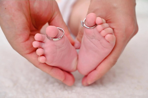 招远孕妇怎样预防妊娠纹